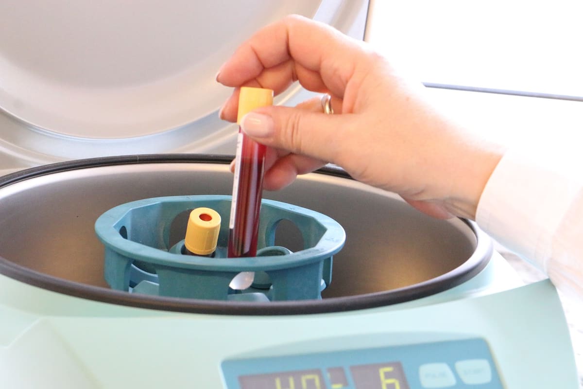 Diagnóstico del Alzheimer con análisis de sangre